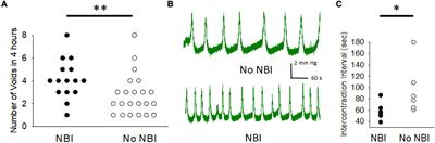 Neonatal Bladder Inflammation Results in Adult Female Mouse Phenotype With Increased Frequency and Nociceptive Responses to Bladder Filling